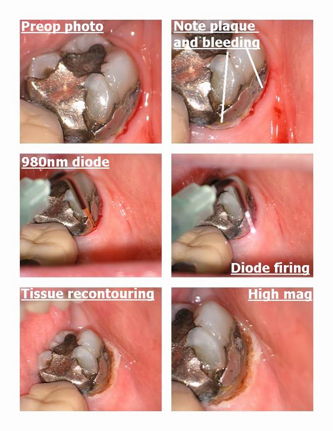 Resize of 2 laser case pg 1.jpg